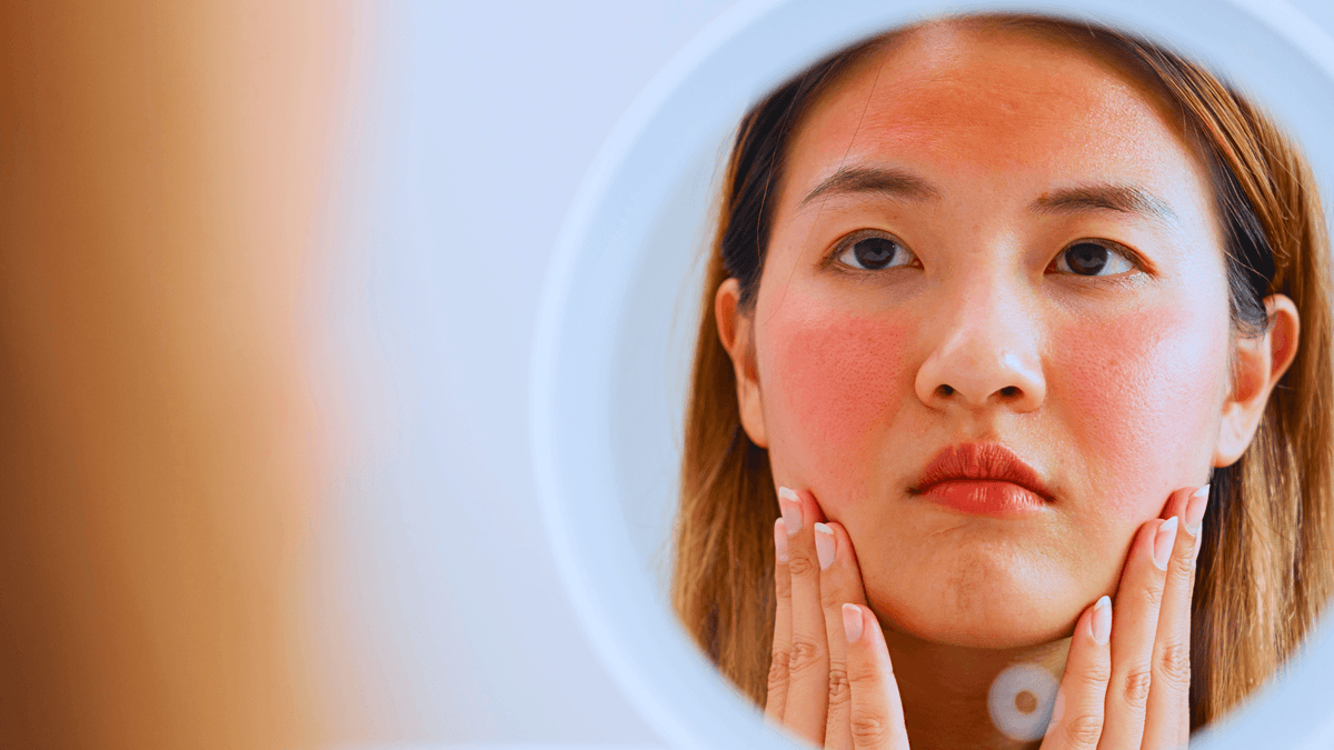 Rosacea Won't Respond to Your Skincare? Here's the Part Everyone Skips
