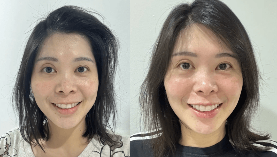 Before and after 30 days